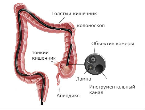 Колоноскопия сантиметр